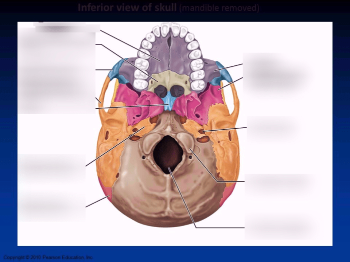 Inferior view of skull mandible removed