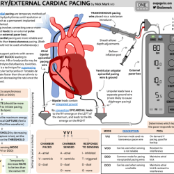 Epicardial wires removal chest pain