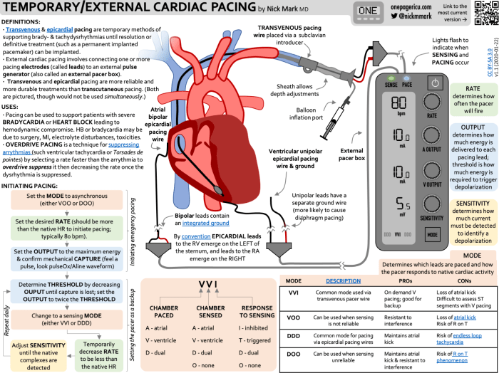 Epicardial wires removal chest pain