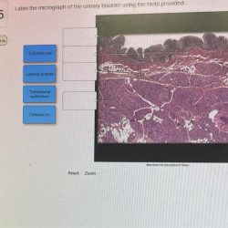 Photomicrograph hints transcription gland suprarenal