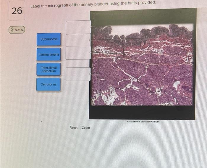 Photomicrograph hints transcription gland suprarenal