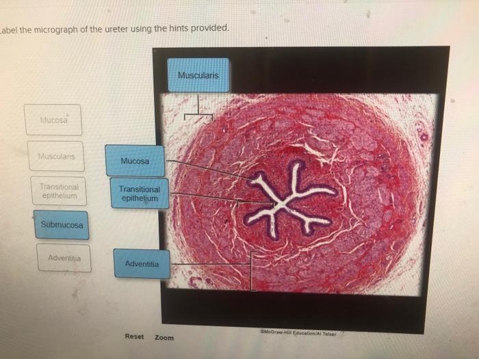 Label the micrograph of the ureter using the hints provided.