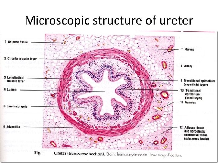 Urinary bladder kidney perirenal micrograph solved gland ureter suprarenal colon ile sigmoid hints homeworklib